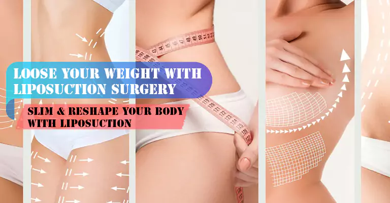 best liposuction delhi loose weight quickly