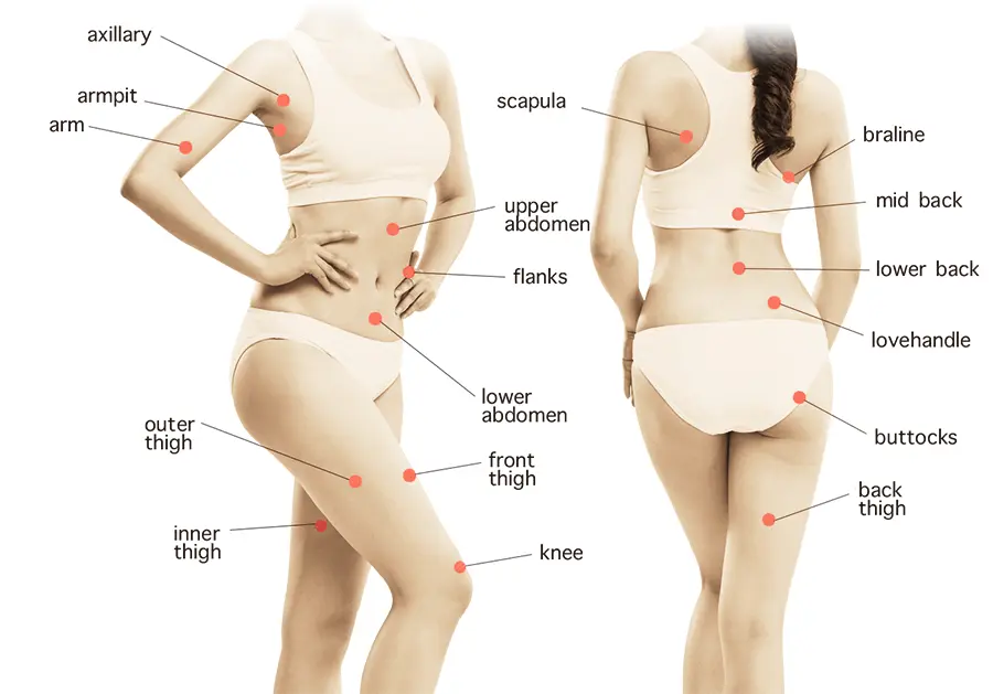 Common Treatment Areas for Liposuction